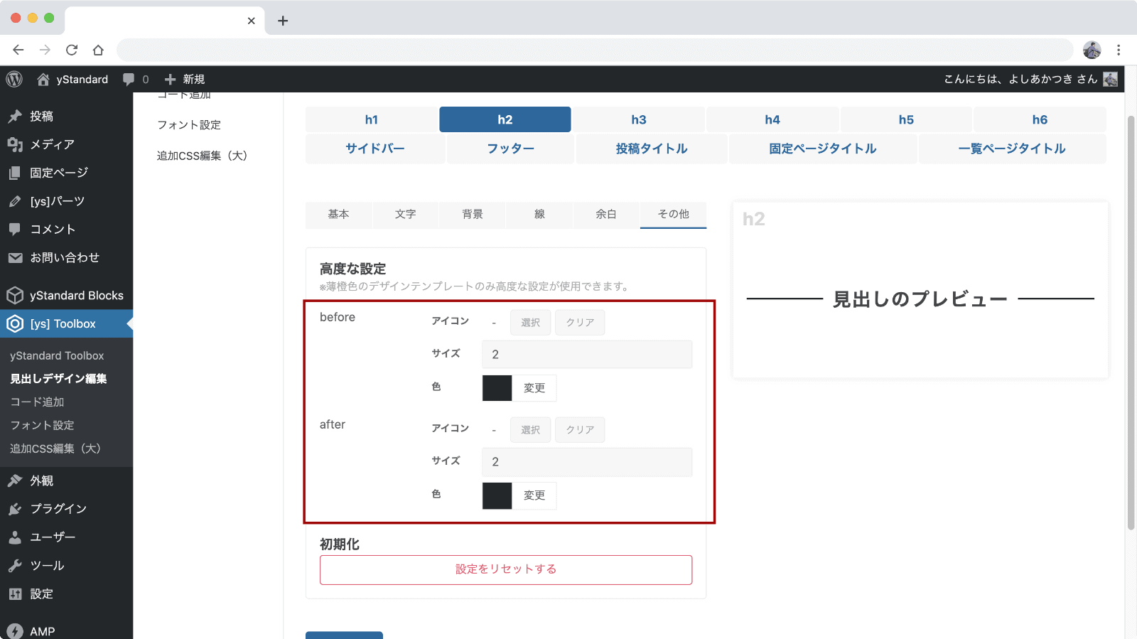 その他の高度な設定